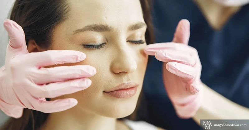 How Can Dermal Fillers Help You Achieve a More Contoured Facial Profile?: