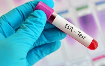 Understanding ESR Test Price: Everything You Need to Know