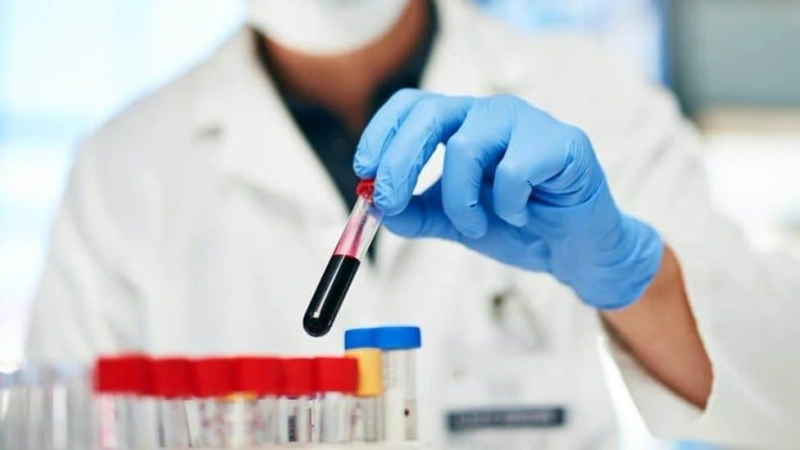 Boy or Girl? Find Your Baby's Gender through Gender Blood Test
