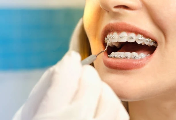 Wilton, CT: Invisalign to Transform Your Everyday Smile