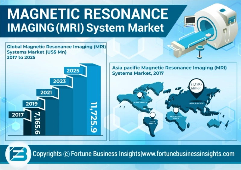 MRI Equipment Market Size, Industry Share, Business Analysis and Growth Forecast to 2026