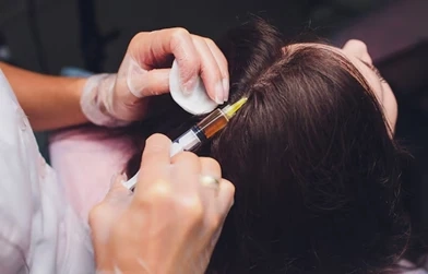 Number of PRP sessions required for Hair growth