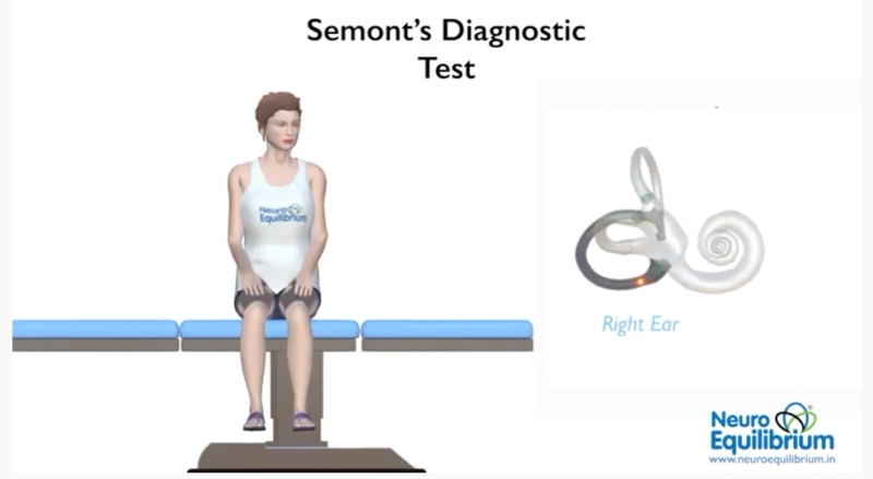 What is an exercise for someone who suffers from vertigo?
