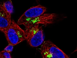 Neuropeptide Y Acetate is emerging as promising diet supplement to treat wide range of neuroligical