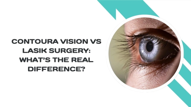 Contoura Vision vs LASIK Surgery: What’s the Real Difference?