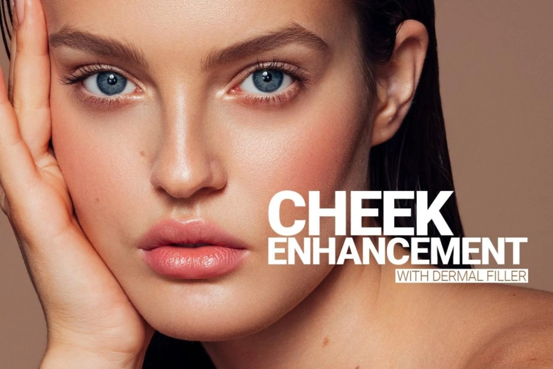 Discover Cheek Transformation: All About Dermal Fillers
