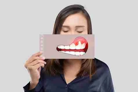 Poor Dental Fit, Big Problem: Gingivitis You Can Prevent