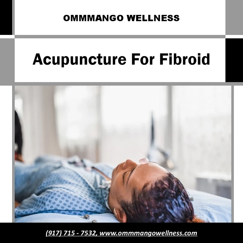 Best Acupuncture for Fibroid | Ommmango Wellness