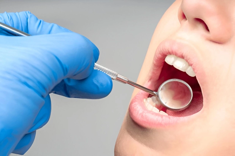 Why Routine Dental Cleanings Are Key to Long-Term Oral Health