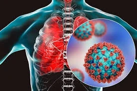 India Meropenem Market to Grow at a Steady Rate During the Forecast Period