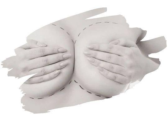 Vaser liposuction
