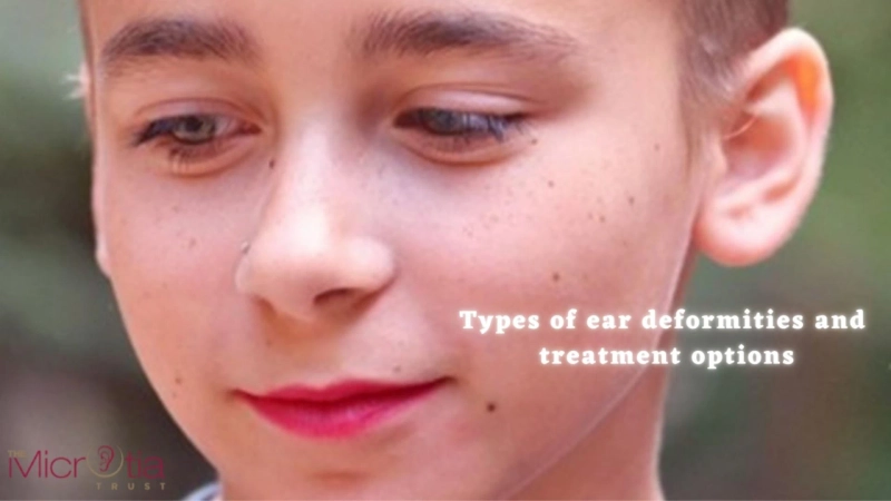 Types of ear deformities and treatment options