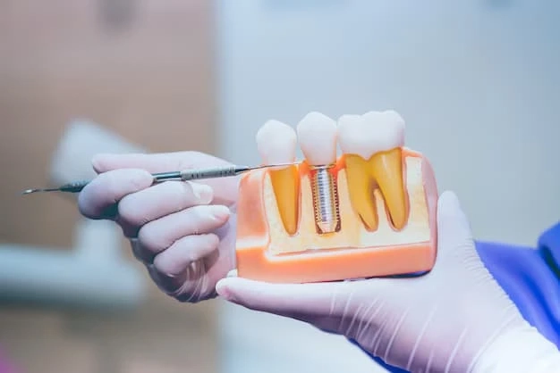 Common Questions About Dental Implants Riverpark Answeredd