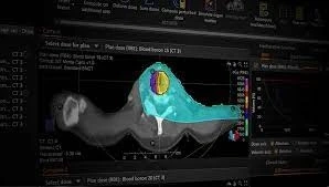 Treatment Planning Systems and Advanced Image Processing Market Growth Prospect, Future Trend, Comprehensive Analysis and Forecast