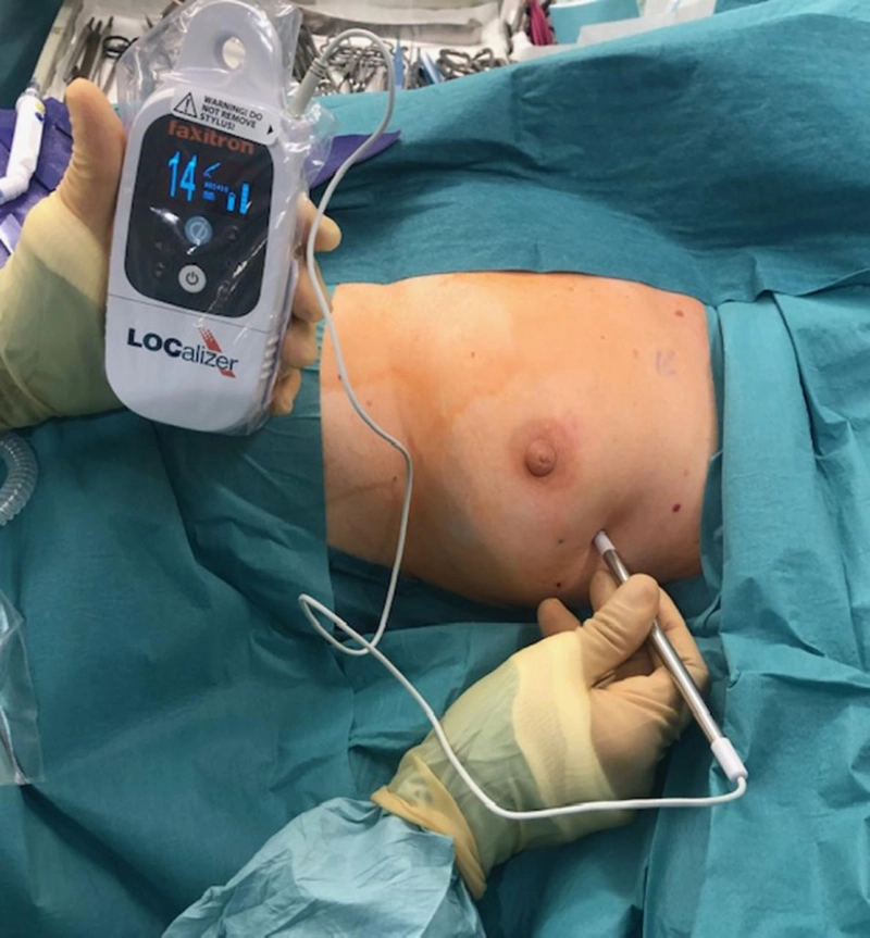 Breast Lesion Localization Methods Market Size, Demand, Outlook, Key Players and Forecast 2023-2028