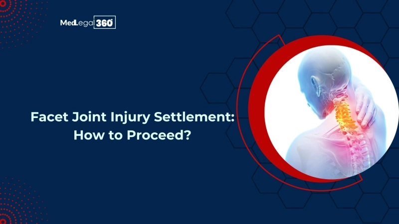 Facet Joint Injury Settlement: How to Claim?