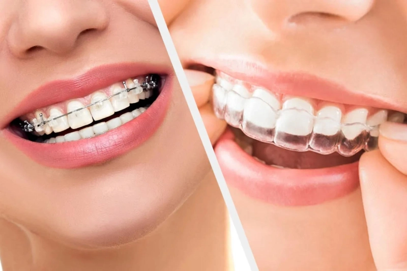 Orthodontist in RR Nagar