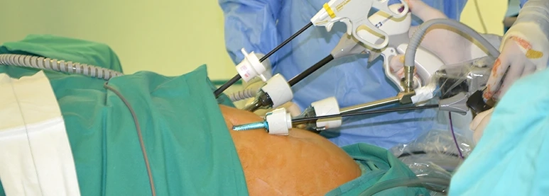 LAPAROSCOPY