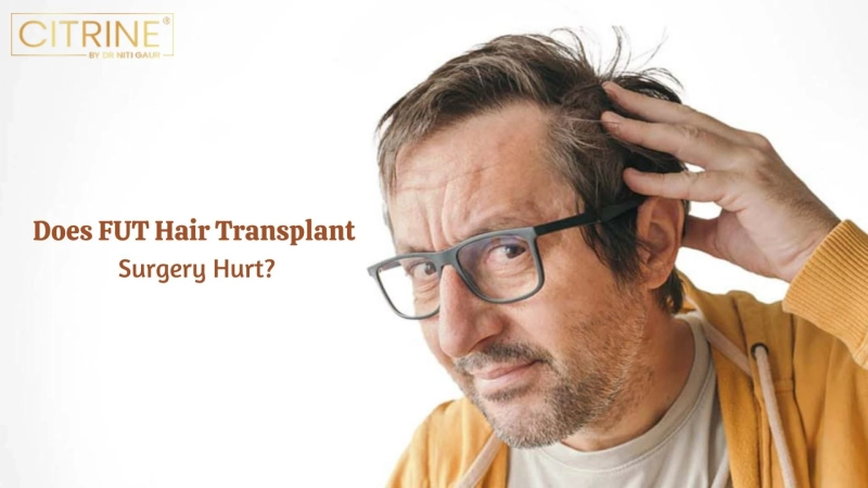 Does FUT Hair Transplant Surgery Hurt?