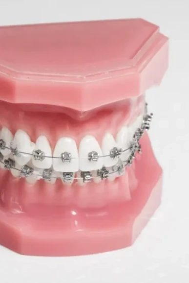 Achieve a Healthier, More Confident Smile in Marietta