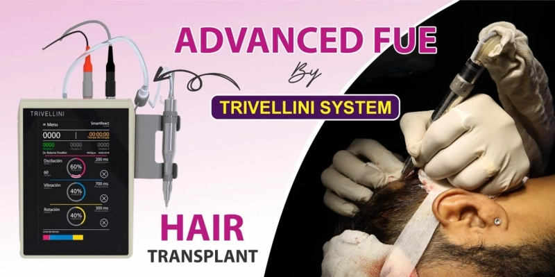 Explain The Working Process of Trivillini Machine For FUE