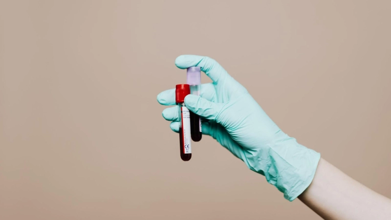 What White Blood Cell Variations Indicate About Your Immunity
