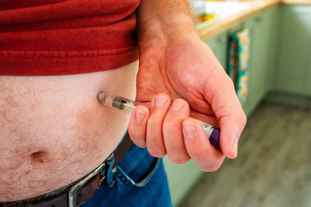 Mongaro Injection for Arthritis: Effective Relief Strategies