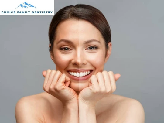 Cosmetic Dentistry Treatment In Rancho Cucamonga