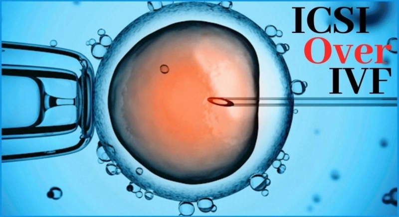 When is the right time to choose ICSI over IVF?