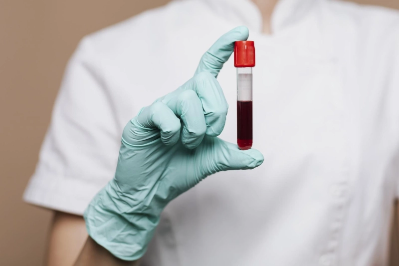 Beta hCG Test: Understanding Beta Quantitative hCG Levels in Pregnancy