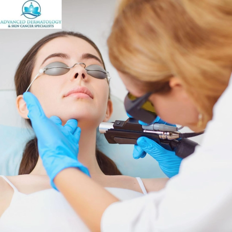 SRT Dermatology: A Smarter Way to Treat Skin Cancer Without Surgery