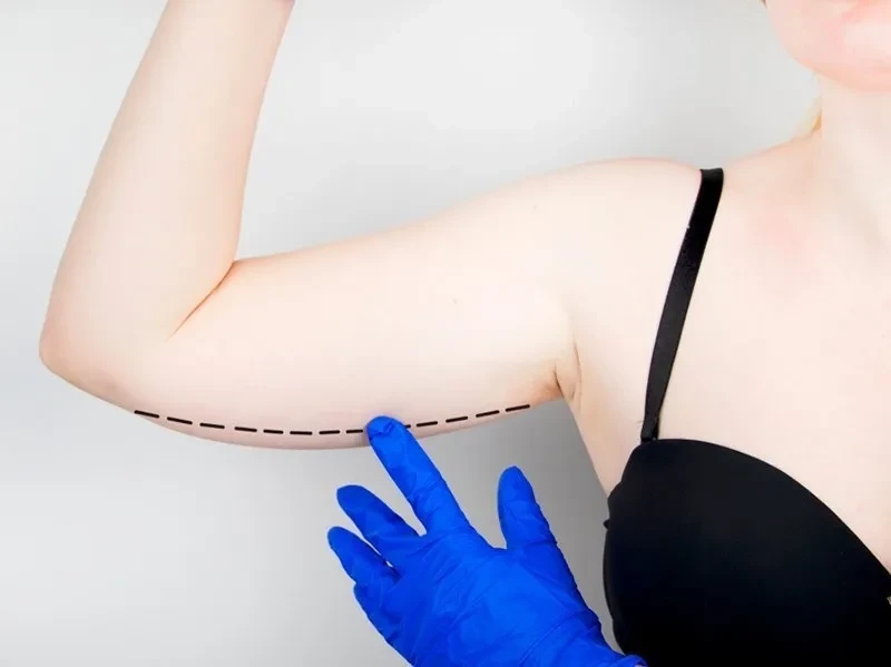 Plastic Surgery Vacation: Health Benefits of Plastic Surgery