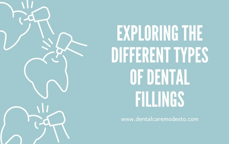 Different Types of Dental Fillings