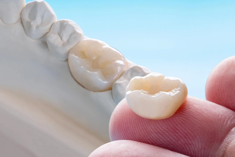 Are Porcelain Crowns the Best Solution for Damaged Teeth?