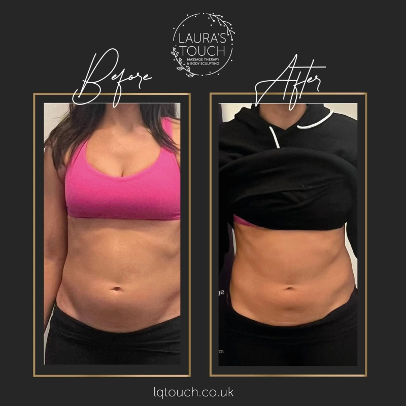 Body Contouring Myths vs. Facts