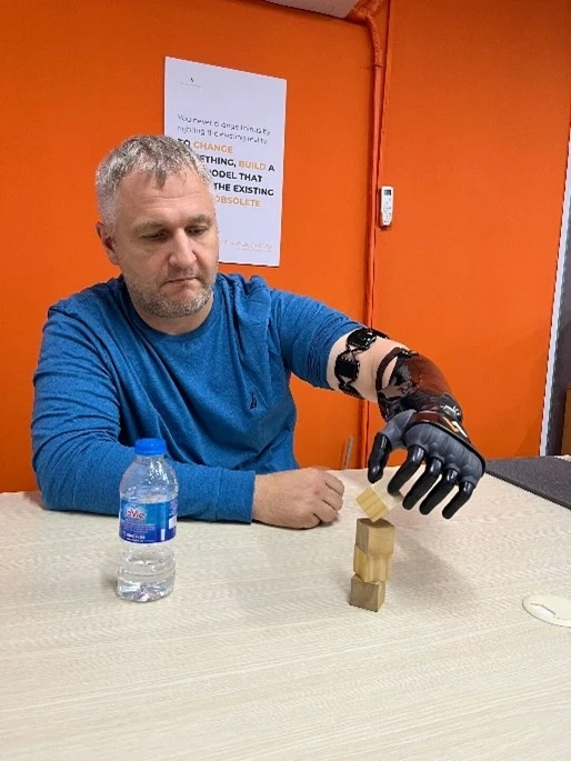 Mind-Controlled Prosthetic Hands: A Glimpse into the Future of Bionic Technology