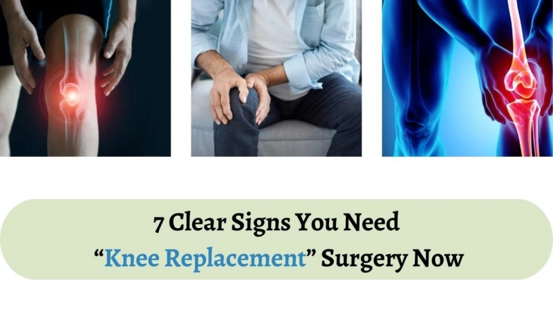 7 Clear Signs You Need Knee Replacement Surgery Now