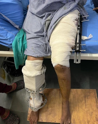 Limb Lengthening Surgery in India: Achieve Your Dream Height