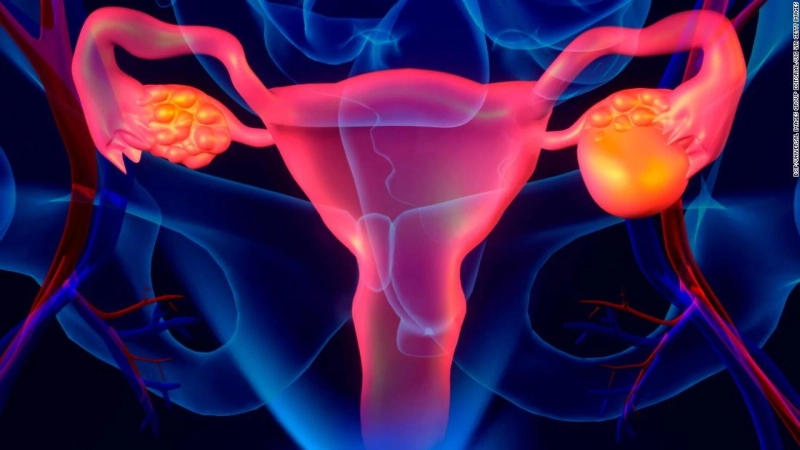 Breaking Down Ovarian Cancer Drugs: Understanding Treatment Options