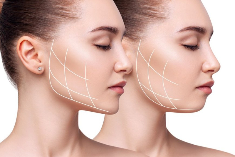 Unveiling the Secrets of Facial Rejuvenation Restoring Youthful Radiance