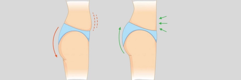 Beautify Your Back with Brazilian Butt Lift