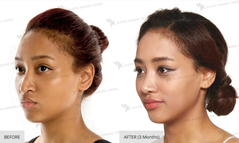 Choose The Well-Known Clinic To Receive The Best Plastic Surgery In Korea