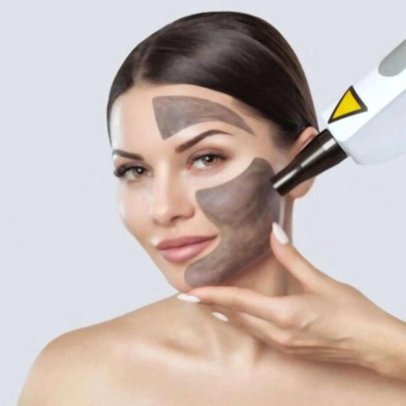 Carbon Laser Peel Treatment: The Secret to Clear, Radiant, Youthful Skin