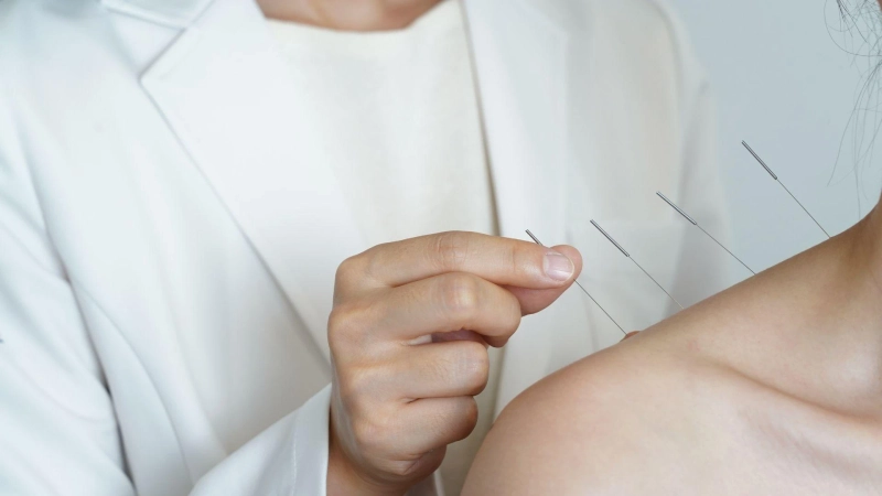 5 Signs You Might Benefit From Orthopedic Acupuncture