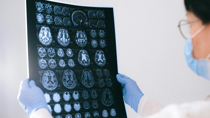 Unveiling the Brain and How Alzheimer’s Shapes Thought and Memory