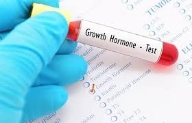 Growth Hormone Deficiency Market: Industry Analysis, Opportunity and Forecast to 2027