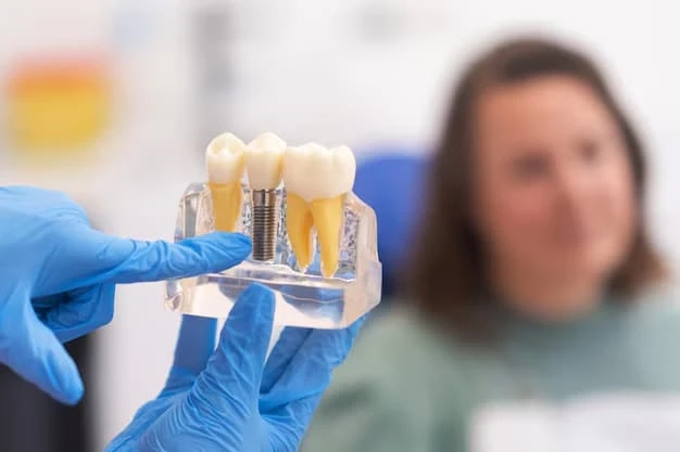 The Step-by-Step Process of Getting Dental Implants in Ventura