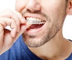 10 Reasons to Invest in Invisalign Braces Treatment in Dubai