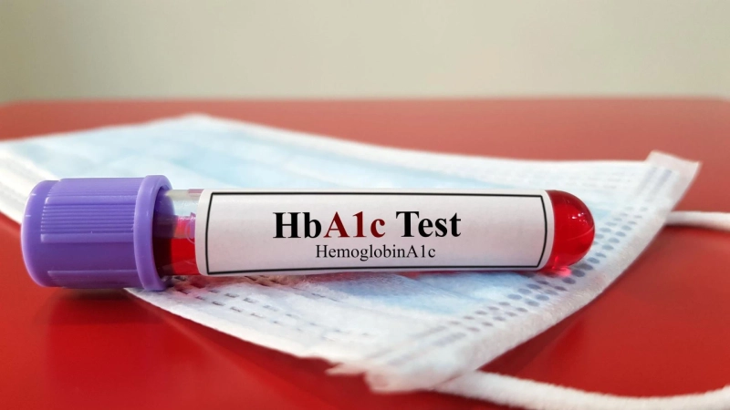 Metabolic Flexibility: How Diagnostic Tests Measure It