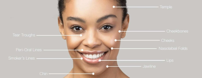 Elevate Your Beauty to New Heights: A Journey Through Facelift Surgery